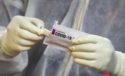 All you need to know about home testing Covid-19 kits