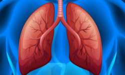 Cells damaged by chronic lung disease can result in severe Covid